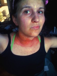 Acupressure Allergy Relief
